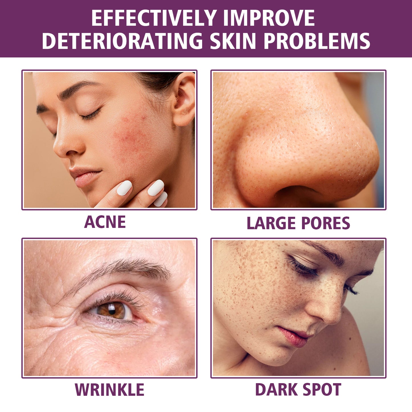 Sérum EELHOE Niacinamide – Sérum Éclaircissant, Anti-Rides & Réducteur de Pores