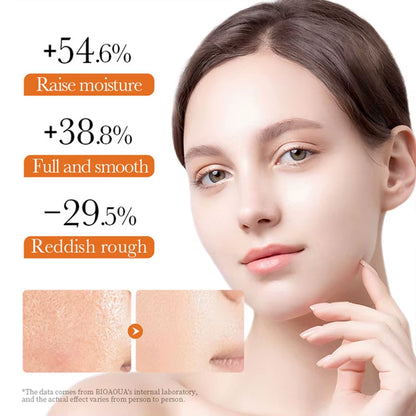 Vitaminc Face Cream Skincare Pigment Spots Freckles Remover Whitening Moisturizing Anit-Aging Beauty Health Cosmetics